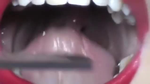 Russian girl uvula and open mouth